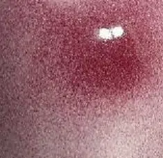 Magma MST860 Amarylis