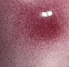 Magma MST860 Amarylis